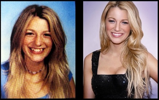 denti blake lively