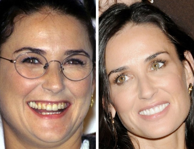 denti demi moore