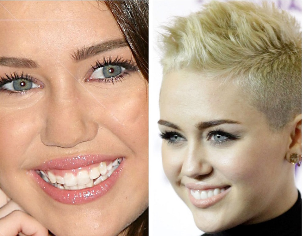 denti -mileycyrus